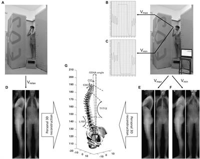 Compensation of Respiratory-Related Postural Perturbation Is Achieved by Maintenance of Head-to-Pelvis Alignment in Healthy Humans